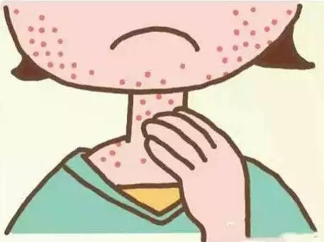 我不敢抓但是牛皮鲜实在太痒了 我不敢抓但是牛皮鲜实在太痒了