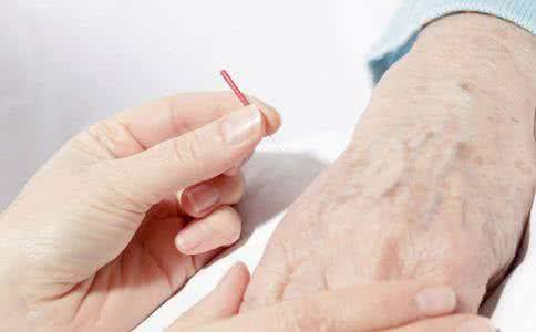 出现关节型牛皮癣要避免感染 出现关节型牛皮癣要避免感染