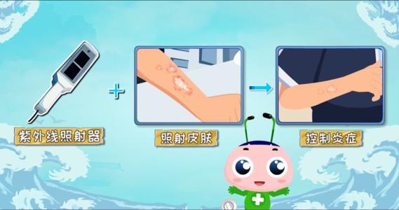 银屑病还能治好吗