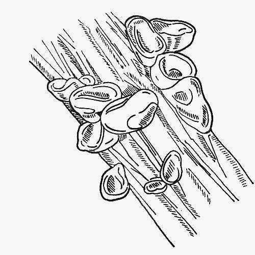 吃木耳对于牛皮鲜病情的恢复有什么好处呢 吃木耳对于牛皮鲜病情的恢复有什么好处呢