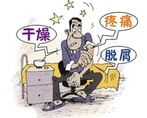银屑病谣言你有没有中招