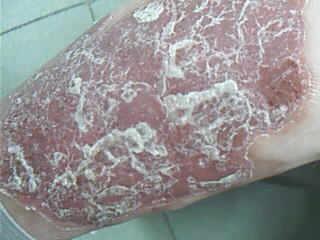 日常生活如何管理牛皮鲜